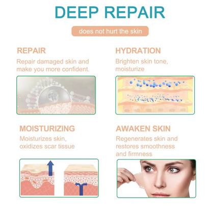 Elunara™ Scar Removal Tape