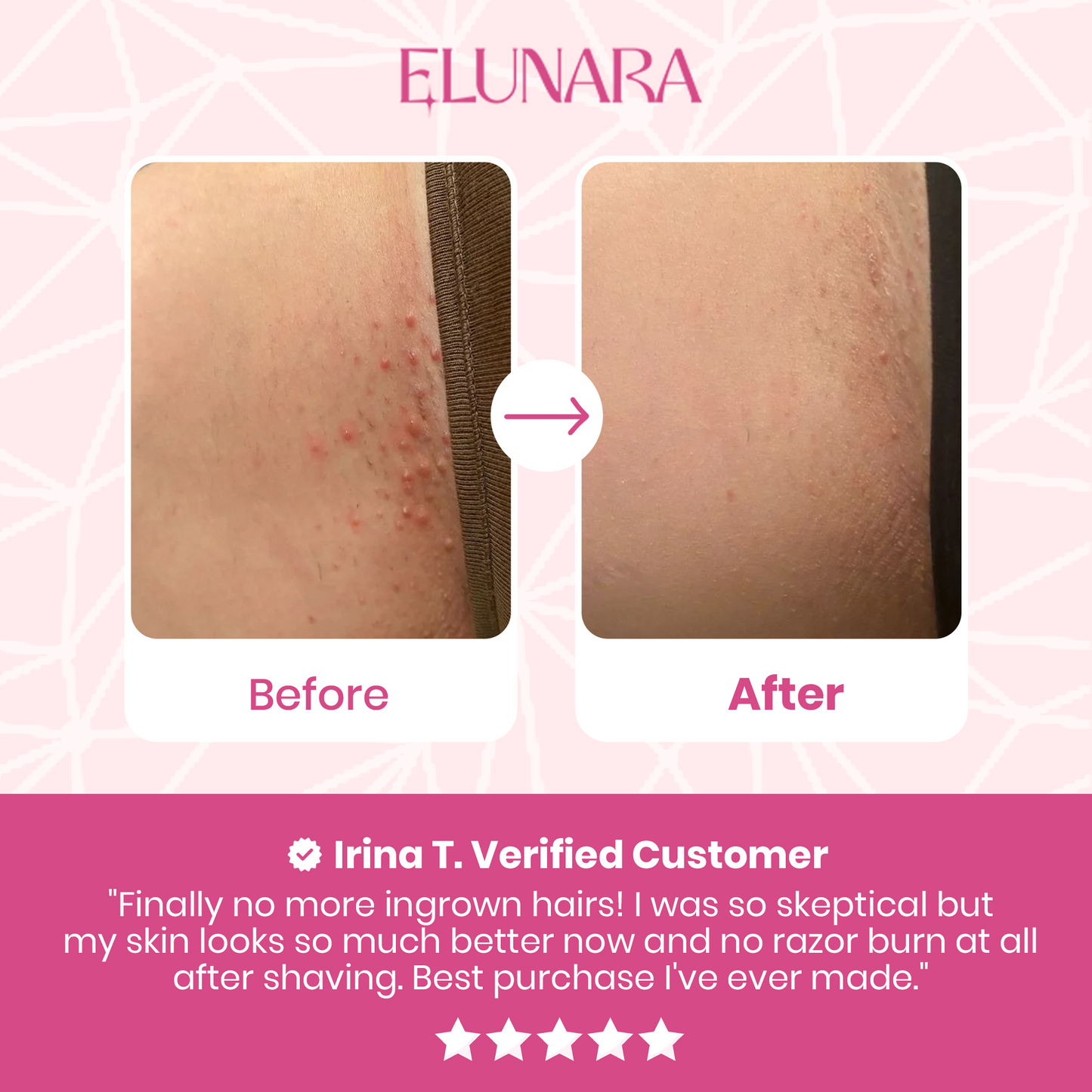 IntimateGlide™ Pro.