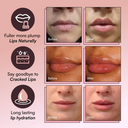 Elunara™ Lip Roller (+ Free Serums)